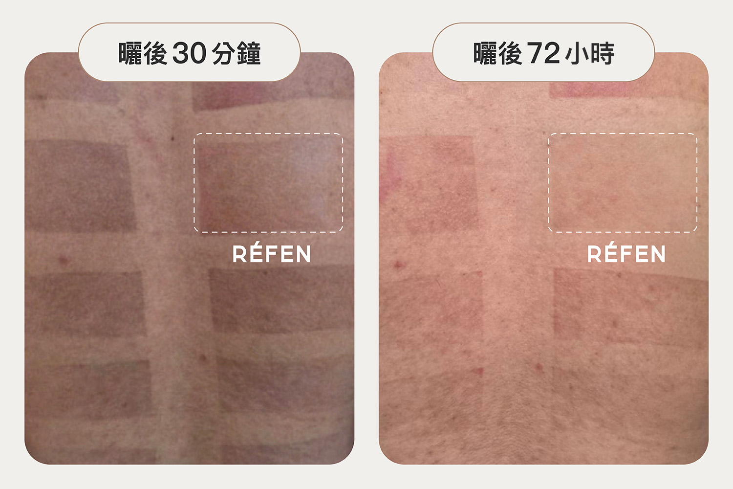 REFEN